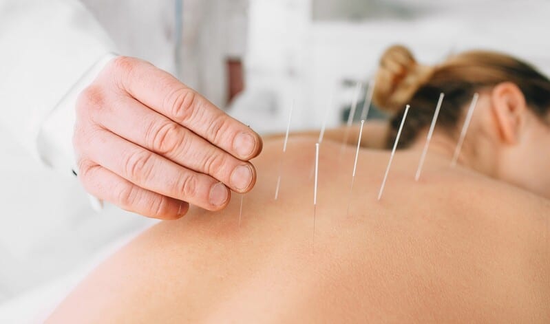 Terapias de acupuntura