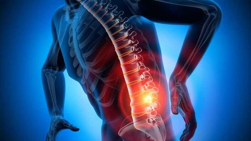 aliviar dolor de espalda baja o lumbago