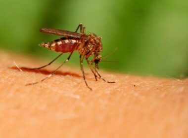 aliviar picaduras de mosquitos remedios